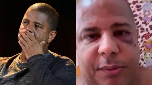 Marcelinho Carioca expõe o que aconteceu. Foto: Mauro Horita/AGIF