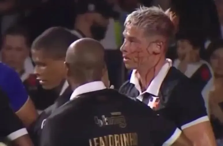 Capasso levou a pior na estreia pelo Cariocão. Foto: reprodução