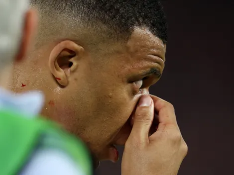 Zagueiro da França atualiza situação de Mbappé após fratura