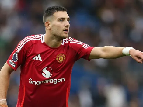 Diogo Dalot tem a pior lesão dos 3 problemas que Ruben Amorim tem