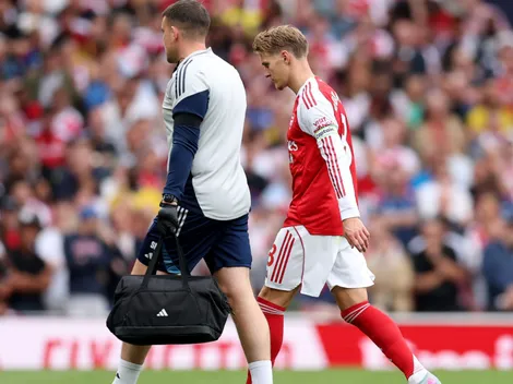 Titular do Arsenal se machuca e vira dúvida para estreia pela Champions League