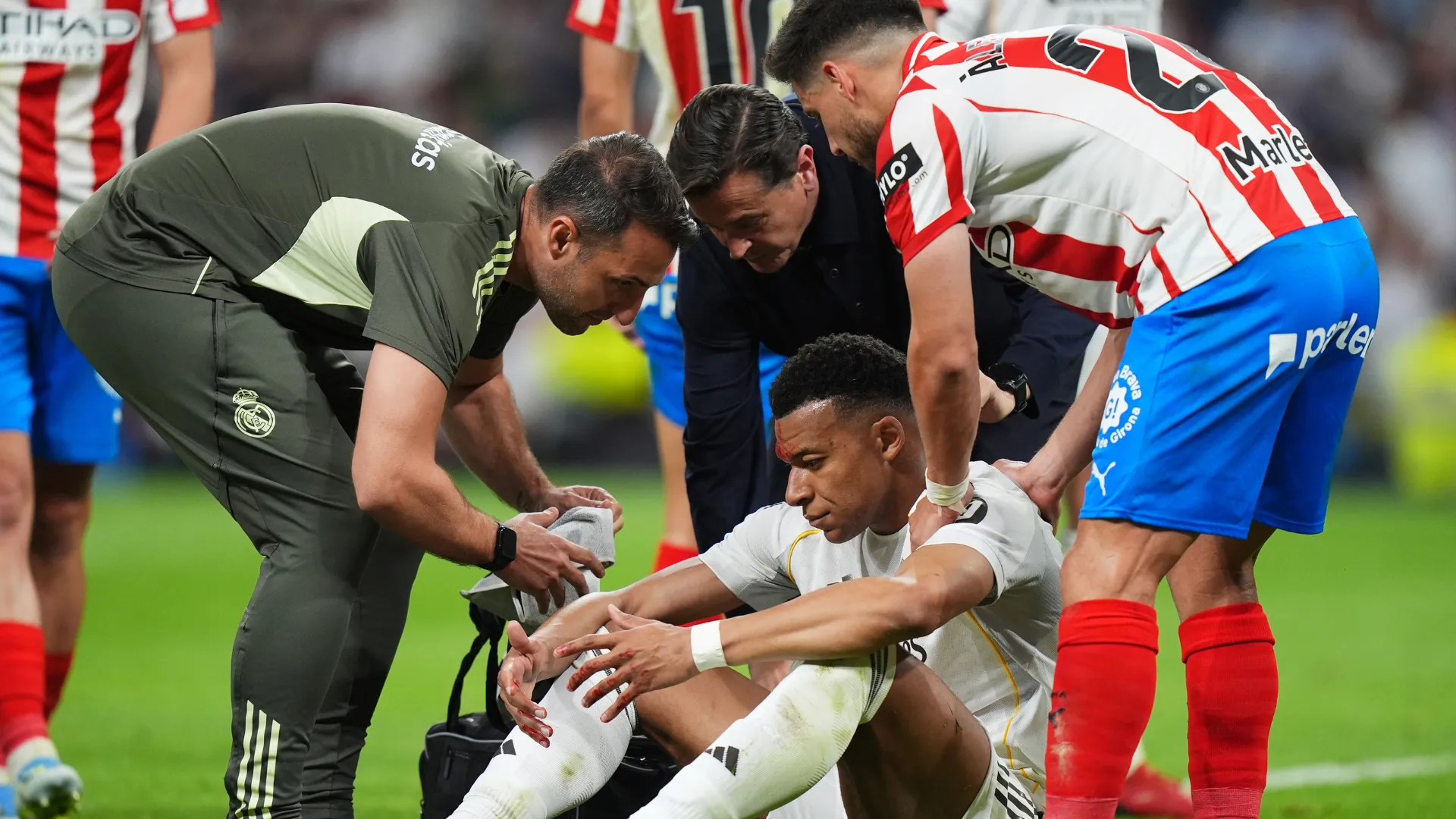 Mbappé sofre lesão durante jogo