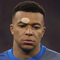 Mbappé chega pressionado na Copa após incômodo no Real Madrid